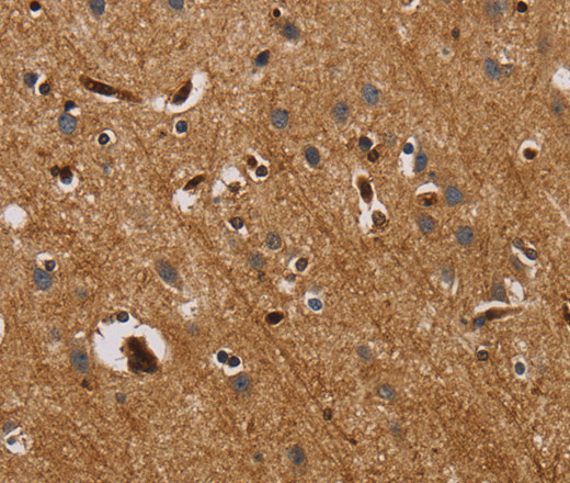 Immunohistochemistry of paraffin-embedded Human brain tissue using IL18R1 Polyclonal Antibody at dilution 1:40