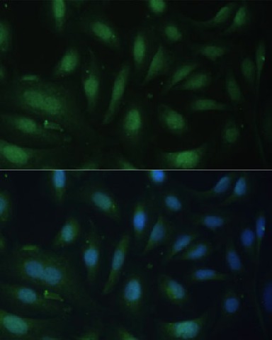 Immunofluorescence analysis of U-2 OS cells using p27 KIP 1 Polyclonal antibody at dilution of 1:100. Blue: DAPI for nuclear staining.