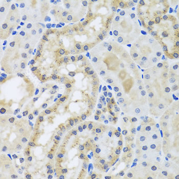 Immunohistochemistry of paraffin-embedded Mouse kidney using CETN3 Polyclonal Antibody at dilution of  1:100 (40x lens).