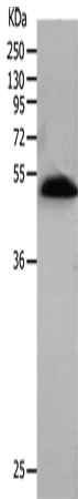 Western Blot analysis of Human lung tissue using BPIFB2 Polyclonal Antibody at dilution of 1:530