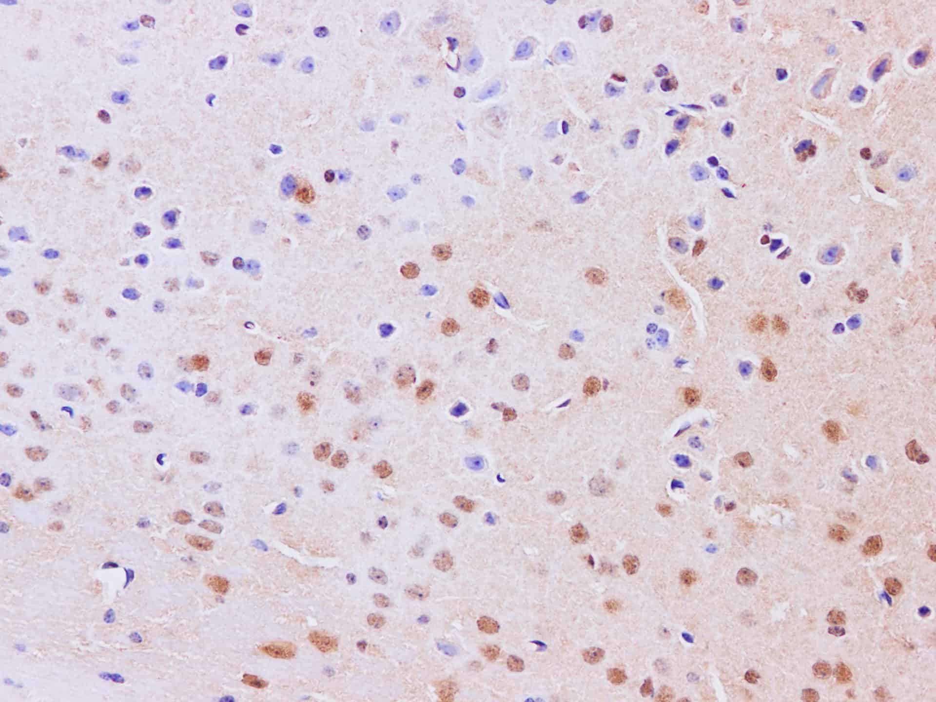 Immunohistochemistry of paraffin-embedded Mouse brain using JNK2 Polyclonal Antibody at dilution of 1:200