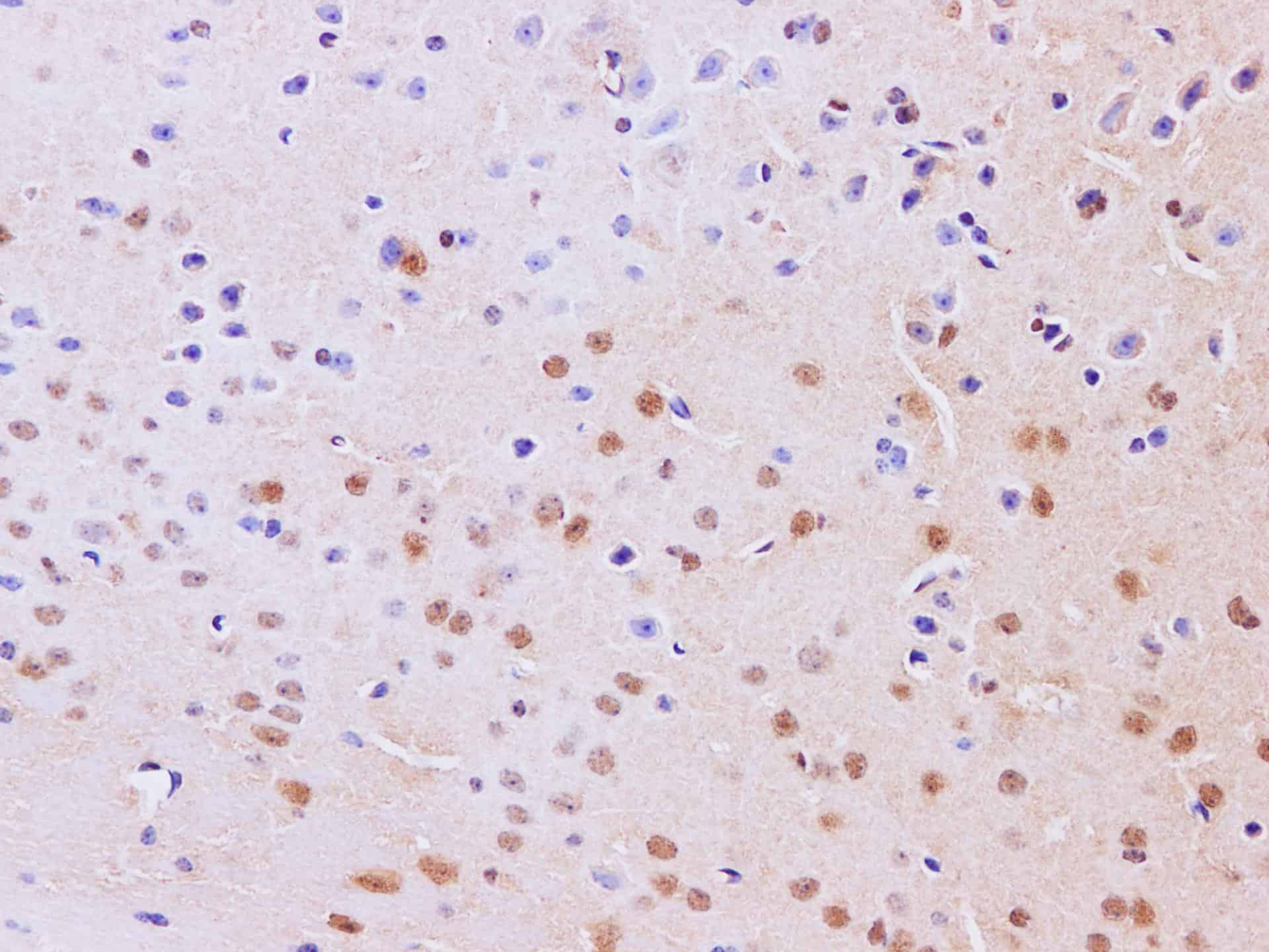 Immunohistochemistry of paraffin-embedded Mouse brain using JNK2 Polyclonal Antibody at dilution of 1:200