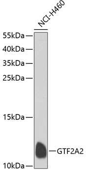 Western blot analysis of extracts of NCI-H460 cells using GTF2A2 Polyclonal Antibody at dilution of 1:1000.