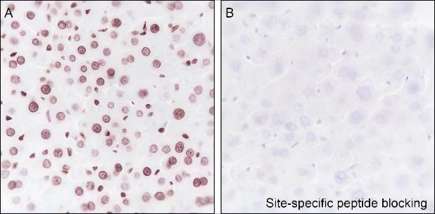 Recombinant Histone H3 (Di Methyl Lys56) Monoclonal Antibody - small - 4