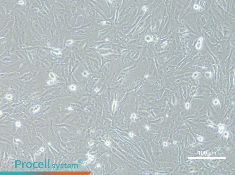 SNU-423 Cell Complete Medium - 1