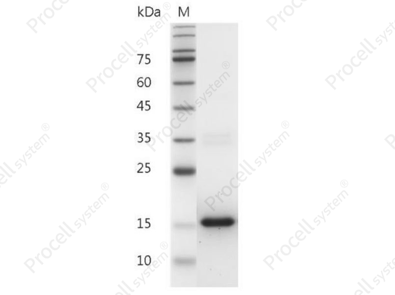 IL-3/HCGFBPA/PSF, Mouse, Recombinant