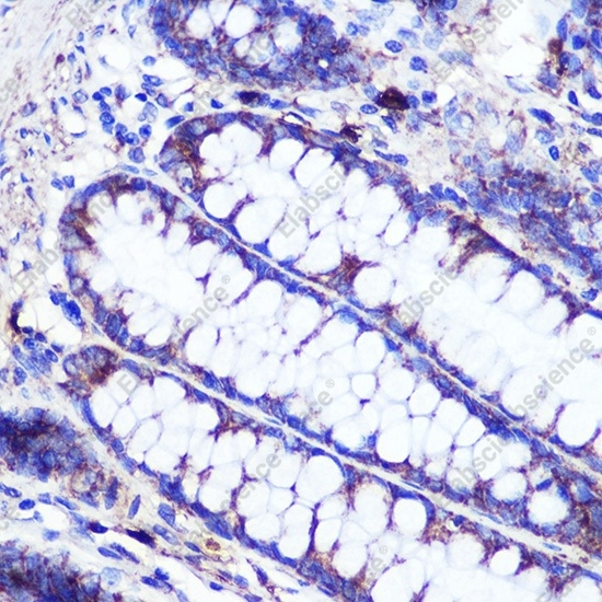 SIRT2 Polyclonal Antibody - 6