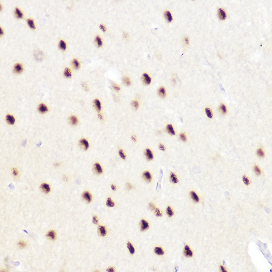 Immunohistochemistry of paraffin-embedded rat brain using CTIP2/BCL11B Polyclonal Antibody at dilution of 1:50 (40x lens).Perform high pressure antigen retrieval with 10 mM citrate buffer pH 6.0 before commencing with IHC staining protocol.