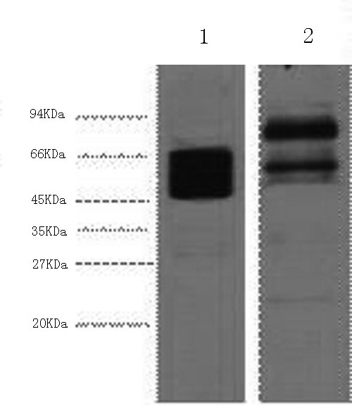 Western Blot analysis of 1) Hela, 2) Mouse brain using CK-8 Monoclonal Antibody at dilution of 1:4000.