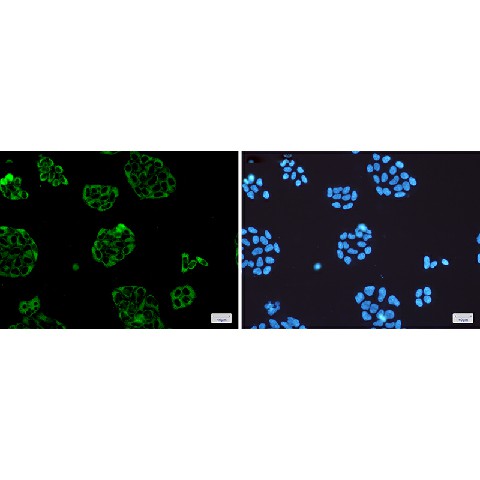 Immunofluorescence of Vinculin(green) in Hela cells using Vinculin Rabbit mAb at dilution 1:50, and DAPI(blue)