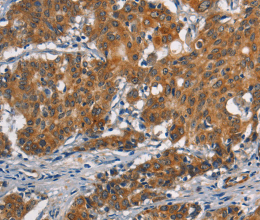 APOL1 Polyclonal Antibody - 2