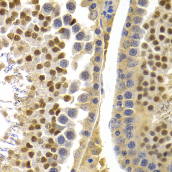 Immunohistochemistry of paraffin-embedded Rat testis using APOBEC3G Polyclonal Antibody at dilution of  1:100 (40x lens).