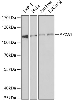 Western blot analysis of extracts of various cell lines using AP2A1 Polyclonal Antibody at 1:1000 dilution.