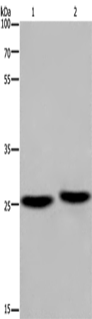 Western Blot analysis of Mouse brain and Human fetal muscle tissue using EPDR1 Polyclonal Antibody at dilution of 1:850