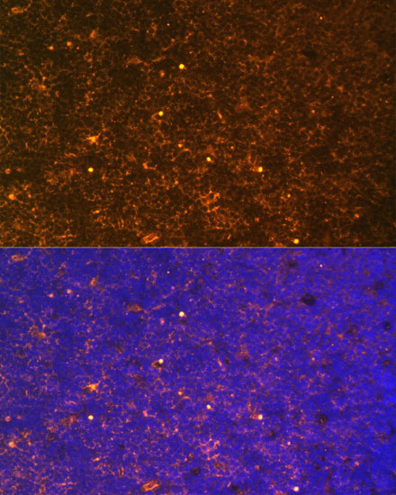 Immunofluorescence analysis of Rat thymus using CTGF Polyclonal antibody at dilution of 1:100. Blue: DAPI for nuclear staining.