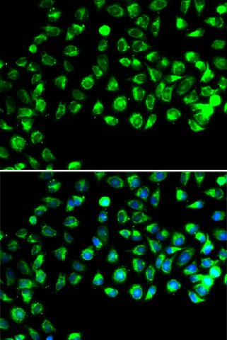 Immunofluorescence analysis of A549 cells using C16orf80 Polyclonal Antibody