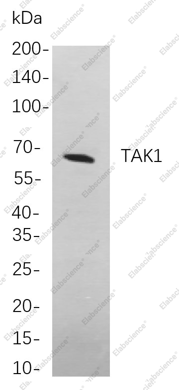 Recombinant TAK1 Monoclonal Antibody - 1