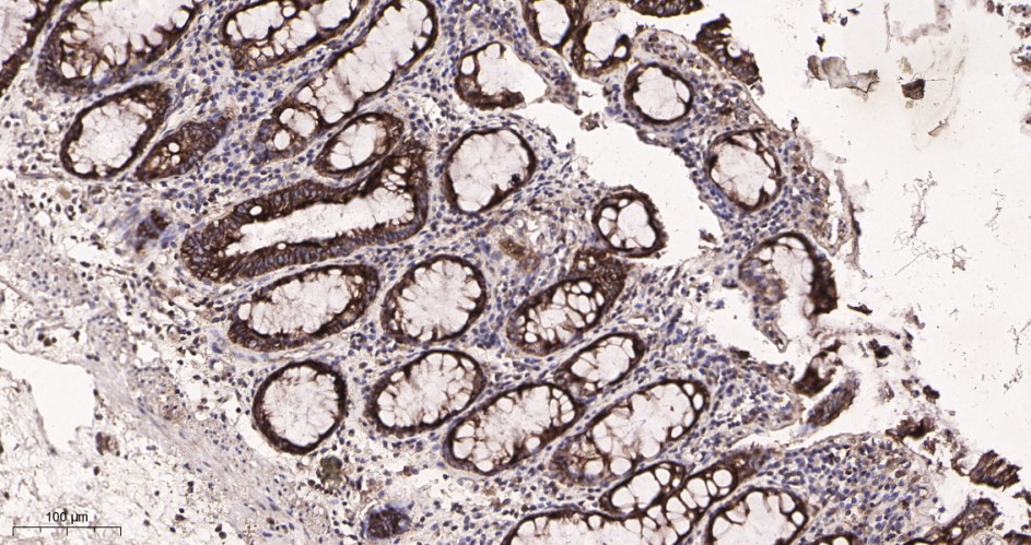 Recombinant ATG5 Monoclonal Antibody - small - 2