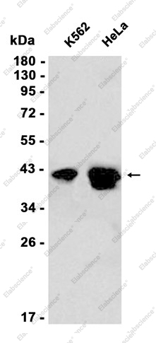 Recombinant PON2 Monoclonal Antibody - 1
