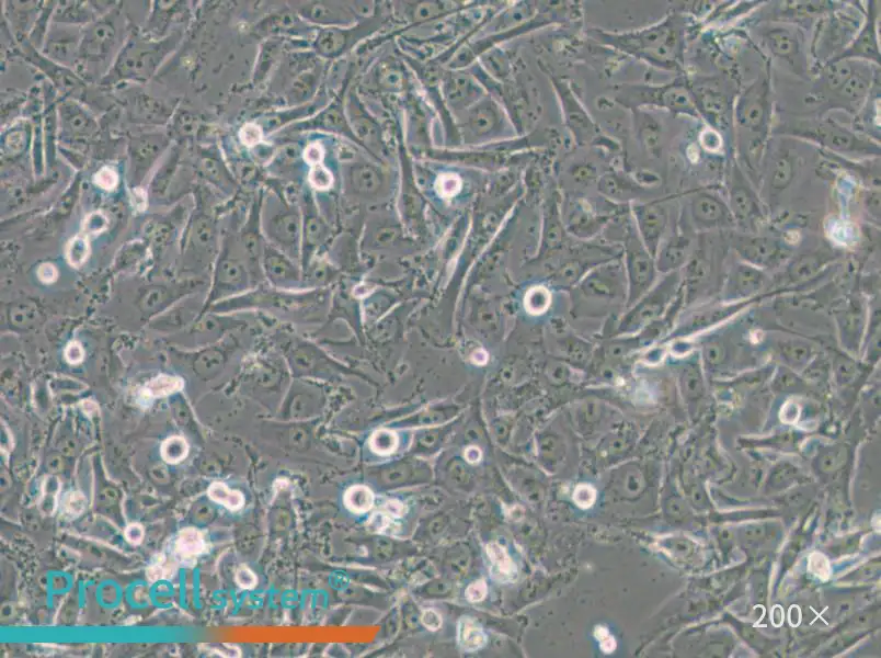 SW1573 (DMEM) Cell Complete Medium - small - 5