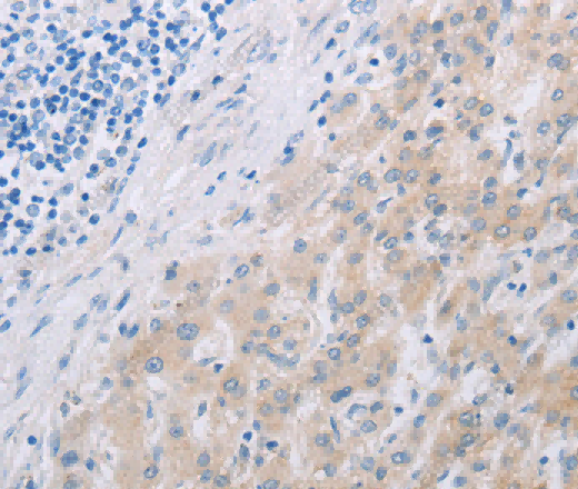 PFN2 Polyclonal Antibody - 3