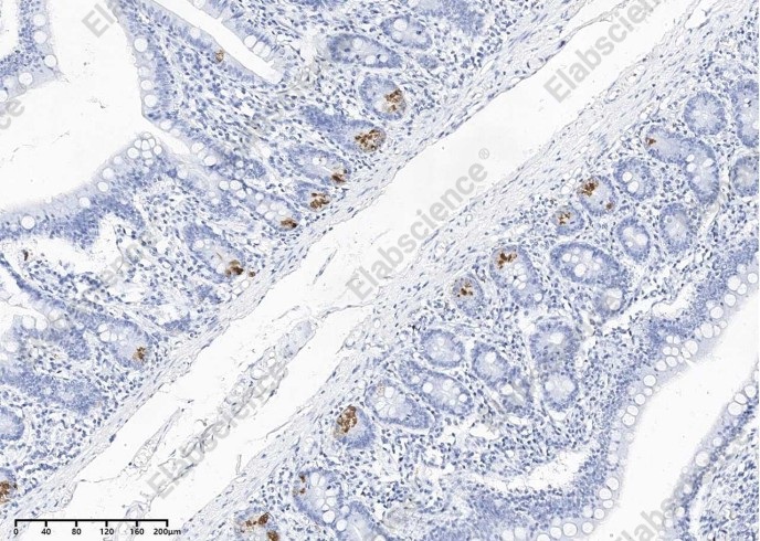 LYZ Monoclonal Antibody - 2