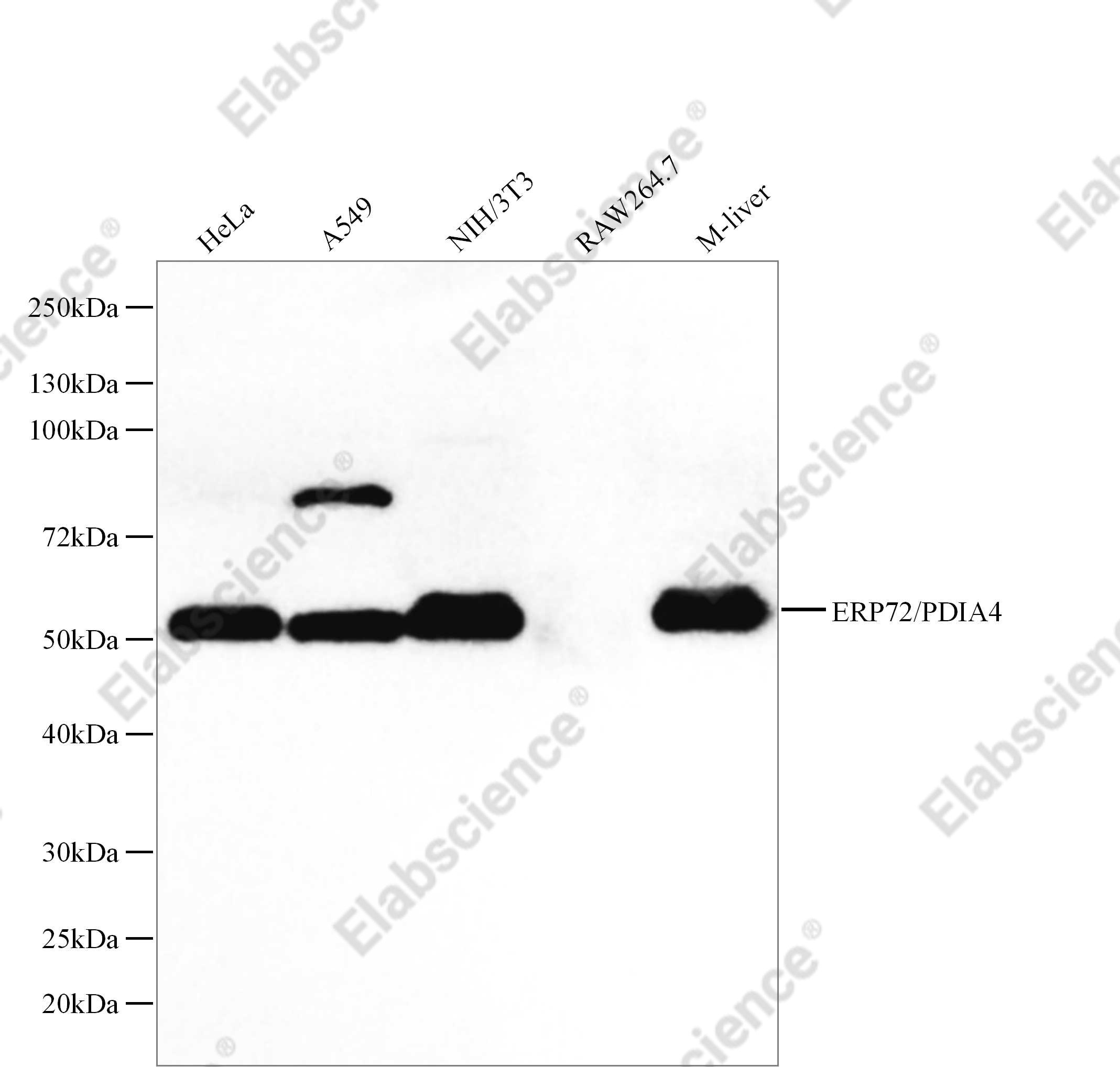 Recombinant ERP72/PDIA4 Monoclonal Antibody - 1