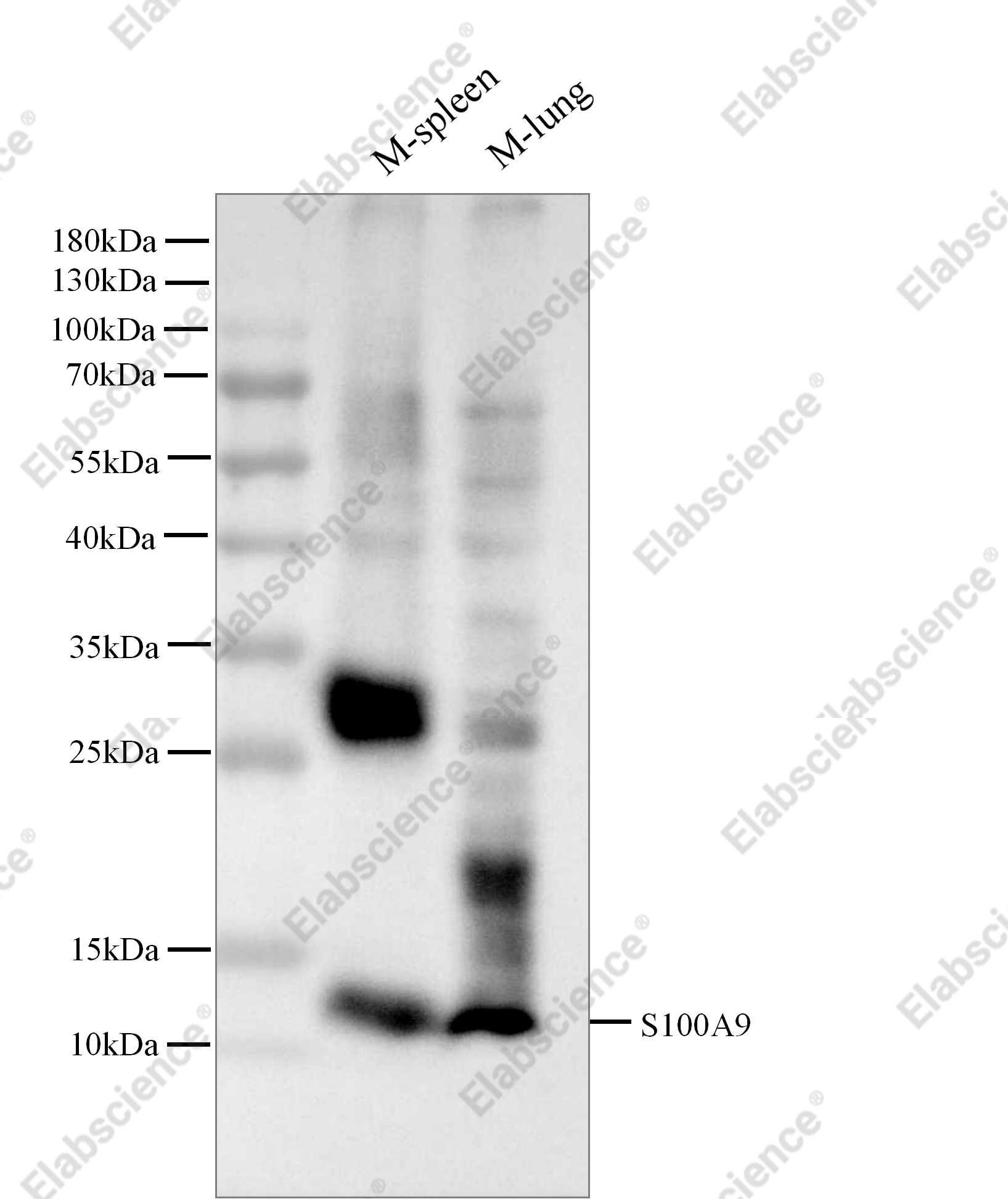 Recombinant S100A9 Monoclonal Antibody - 3