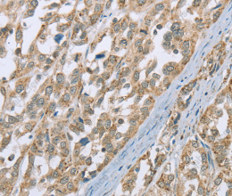 ECHS1 Polyclonal Antibody - 2