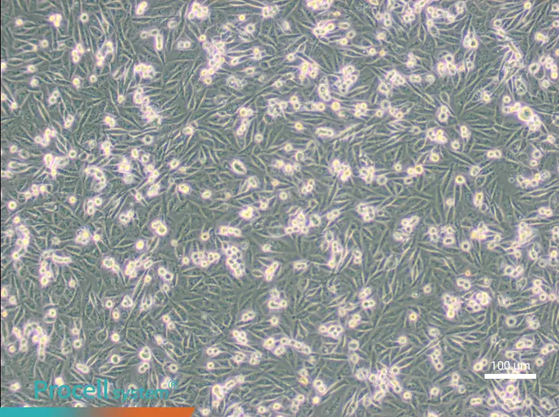MDA-MB-231-GFP - 1