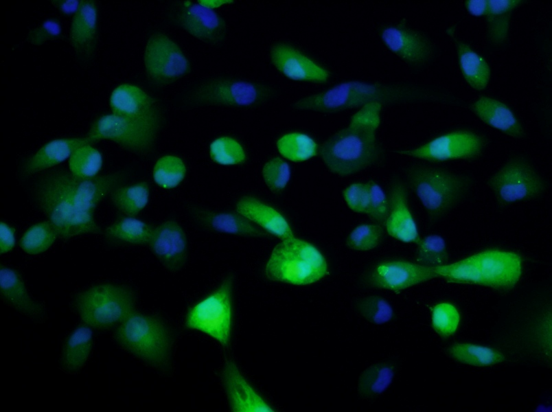 ACHN-GFP Cell Complete MediumACHN-GFP Cell Complete Medium - 3