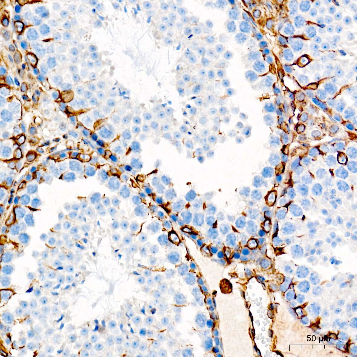 (KO Validated) Vimentin Polyclonal Antibody - small - 7