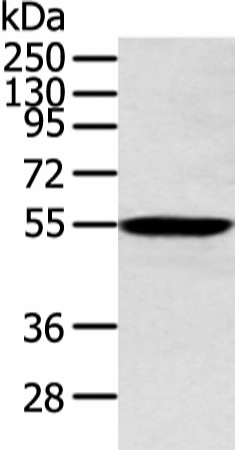 Western blot analysis of Human lung cancer tissue  using ALDH2 Polyclonal Antibody at dilution of 1:300