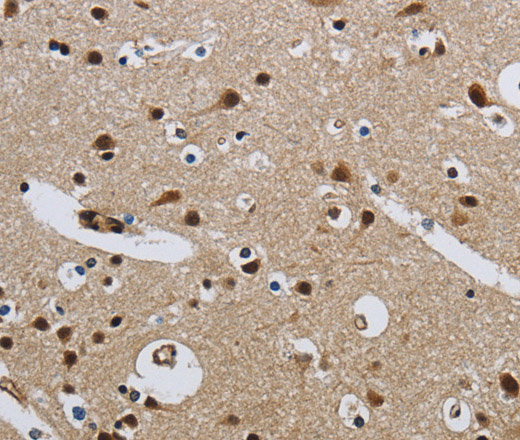 Immunohistochemistry of paraffin-embedded Human brain  tissue using CMTM8 Polyclonal Antibody at dilution 1:40