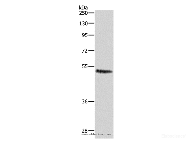 Western Blot analysis of Hela cell using CASP2 Polyclonal Antibody at dilution of 1:1000