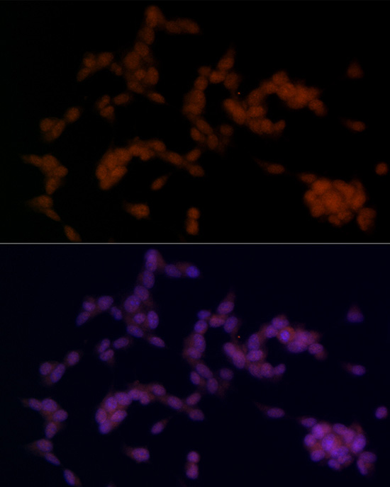 Immunofluorescence analysis of SH-SY5Y cells using SOX11 Polyclonal Antibody at dilution of 1:100 (40x lens). Blue: DAPI for nuclear staining.