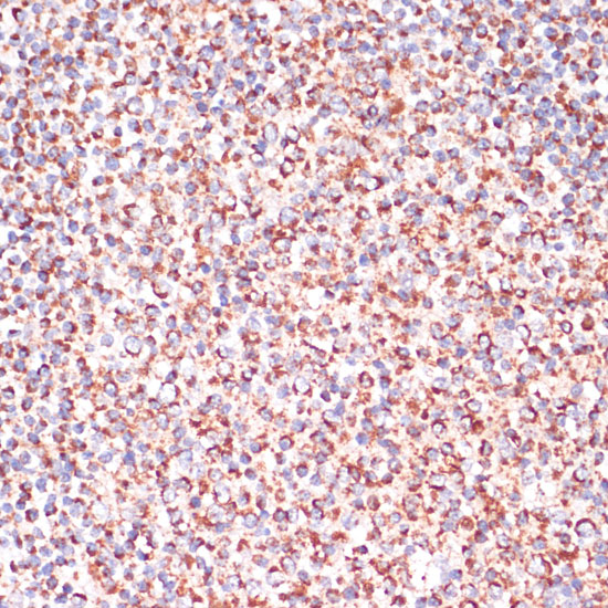 Immunohistochemistry of paraffin-embedded Human tonsil using Caspase-9 Polyclonal Antibody at dilution of 1:100 (40x lens).