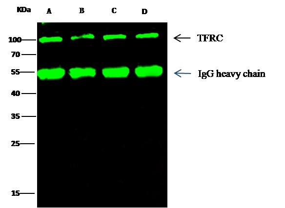 Recombinant Transferrin Receptor/TFRC/CD71 Monoclonal Antibody - small - 3