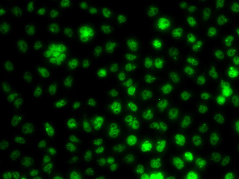 Immunofluorescence analysis of A549 cells using UBE2R2 Polyclonal Antibody