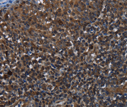 GALT Polyclonal Antibody - 2