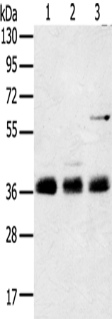 Western Blot analysis of Mouse lung tissue, NIH/3T3 and hepg2 cell using ANKRD1 Polyclonal Antibody at dilution of 1:400