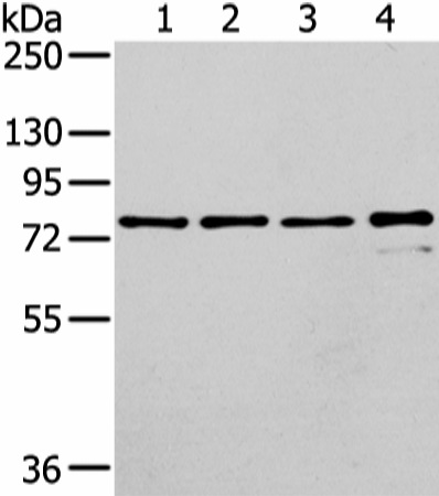 Western Blot analysis of Raji, K562, skov3 and pc3 cell using GHR Polyclonal Antibody at dilution of 1/400