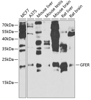 Western blot analysis of extracts of various cell lines using GFER Polyclonal Antibody at 1:1000 dilution.