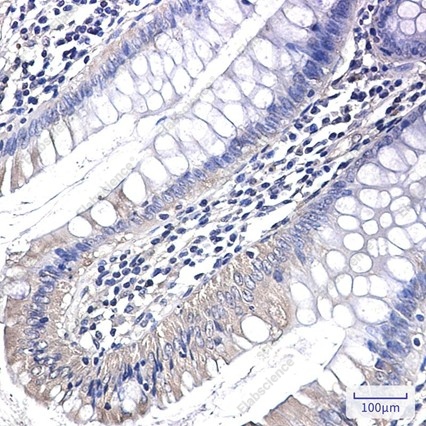 Recombinant PKN1 Monoclonal Antibody - 2