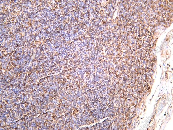 Recombinant HLA-A Monoclonal Antibody - 1
