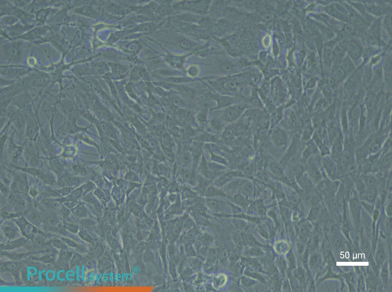 Rat Meningeal Fibroblast Complete Medium - 4
