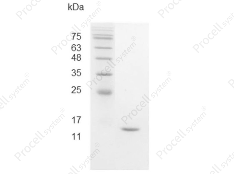 IFN&gamma;/IFNG, Swine, Recombinant