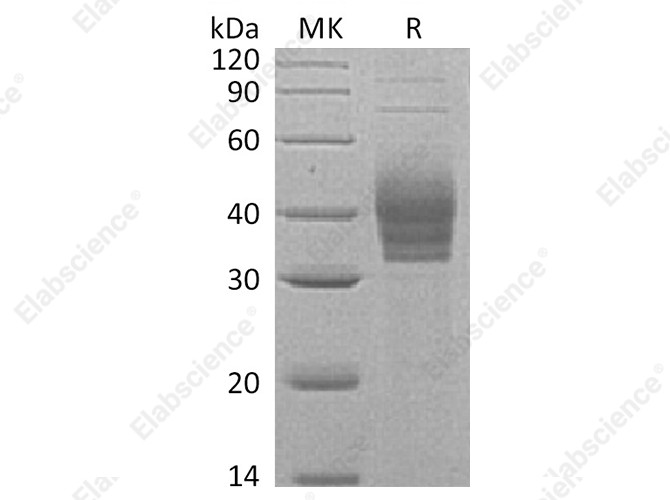 Recombinant Human Cerberus/CER1 Protein (His Tag) - 1