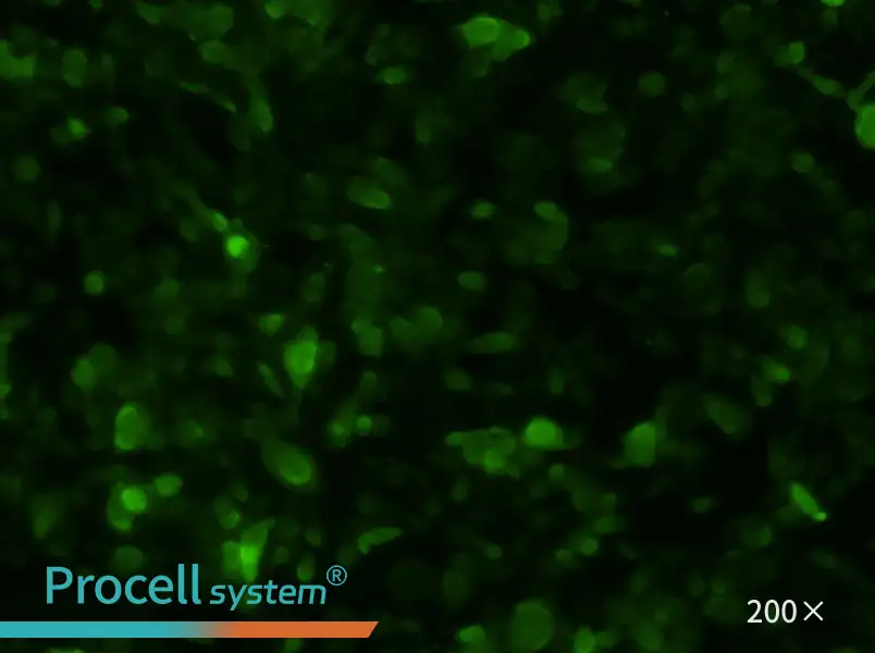 PC-3-GFP Cell Complete Medium - 1