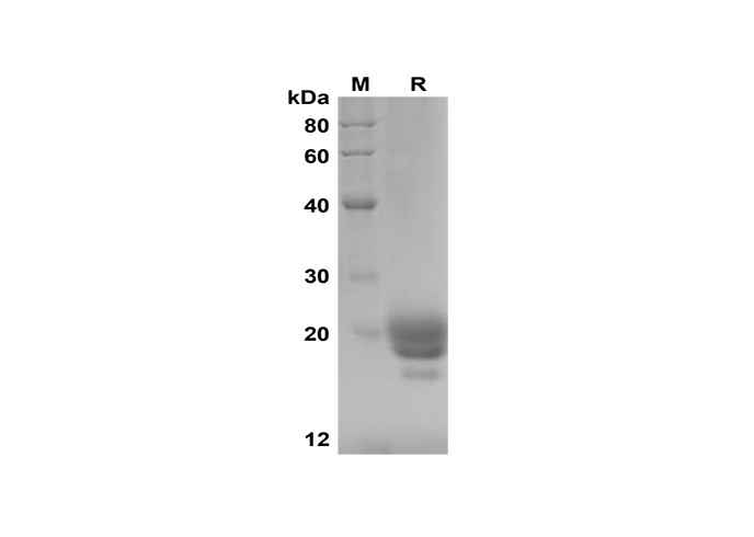 Recombinant Human FGF2 Protein(GST Tag)-产品推荐-1